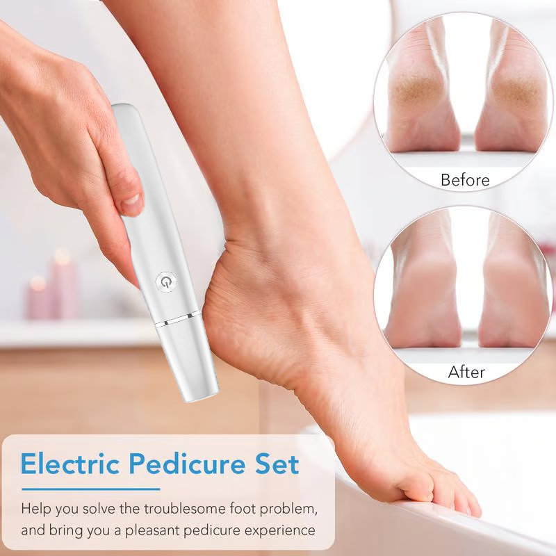 Electric Feet Callus Remover?