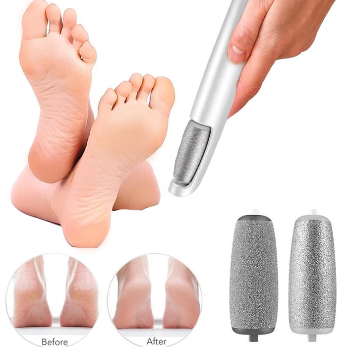 Electric Feet Callus Remover?